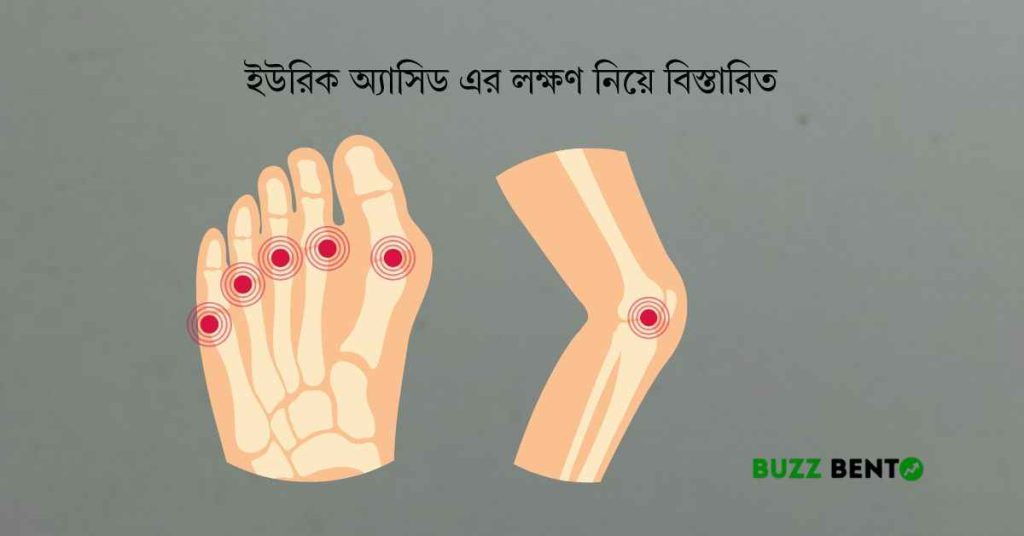 ইউরিক অ্যাসিড এর লক্ষণ