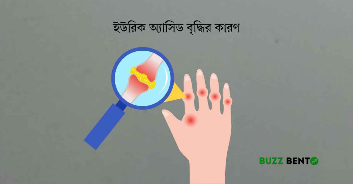 ইউরিক অ্যাসিড বৃদ্ধির কারণ