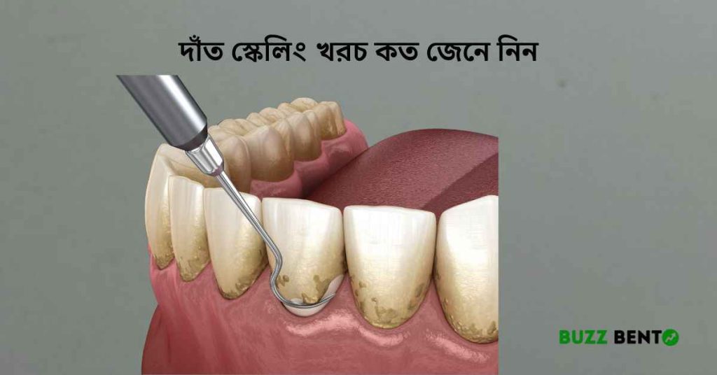 দাঁত স্কেলিং খরচ কত