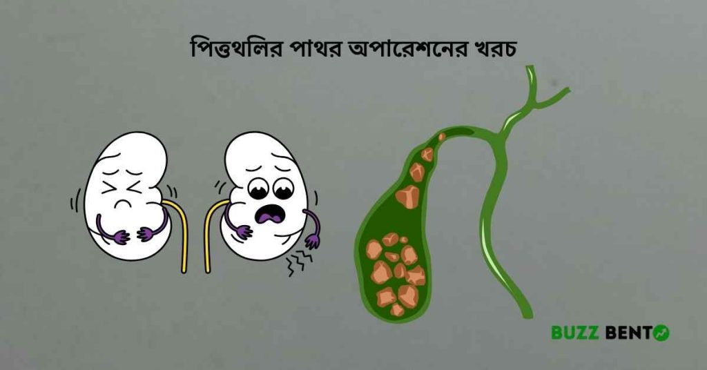 পিত্তথলির পাথর অপারেশনের খরচ