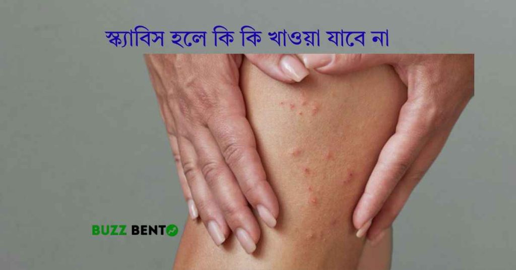 স্ক্যাবিস হলে কি কি খাওয়া যাবে না (ডায়েট + চিকিৎসা ২০২৬)