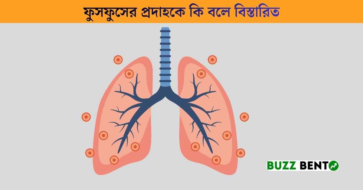ফুসফুসের প্রদাহকে কি বলে বিস্তারিত